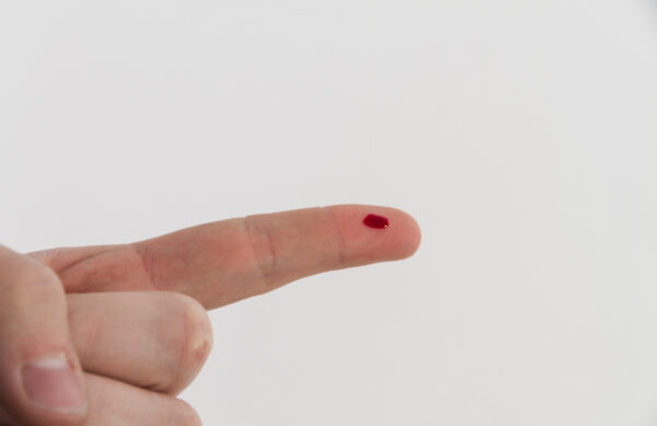 von Willebrand Factor bleeding